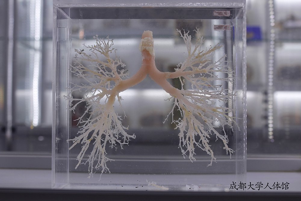 胰的管道